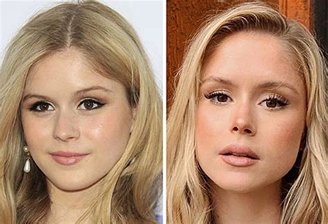 erin moriarty before surgery|Erin Moriarty Plastic Surgery: Debunking the Rumors